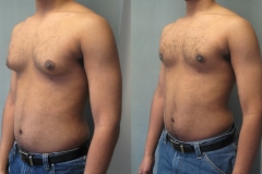 Adolescents-6027-3 Adolescents-6027-3