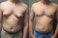 Adolescents-6069-2 Adolescents-6069-2