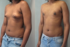 Adolescents-6112-3 Adolescents-6112-3