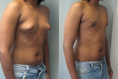 Adolescents-61122 Adolescents-61122