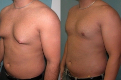 Puffy-Nipples-3485-2