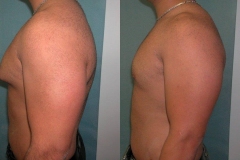 Puffy-Nipples-3485-3