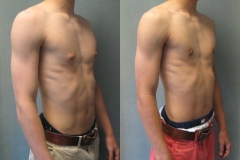 Puffy-Nipples-6145-2