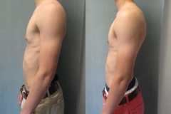 Puffy-Nipples-6145-4