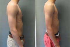 Puffy-Nipples-6145-5