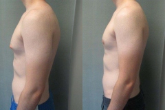 Puffy-Nipples-6472-5