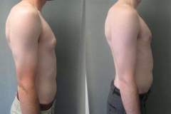 Puffy-Nipples-6592-3