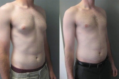 Puffy-Nipples-6592-5