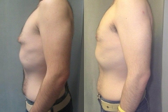 Puffy-Nipples-6749-2