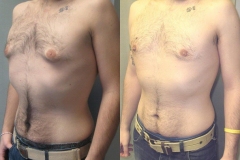 Puffy-Nipples-6749-3