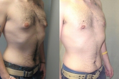 Puffy-Nipples-6749-4