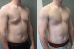 Puffy-Nipples-6770-2