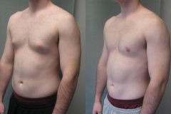 Puffy-Nipples-6770-3