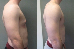 Puffy-Nipples-6770-4