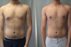 Puffy-Nipples-6902-2