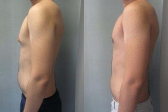 Puffy-Nipples-6902-3