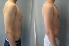 Puffy-Nipples-6902-4