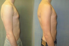 Puffy-Nipples-7246-2