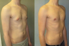 Puffy-Nipples-7246-4