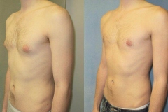 Puffy-Nipples-7246-5