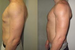 Puffy-Nipples-7279-2