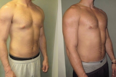 Puffy-Nipples-7279-3