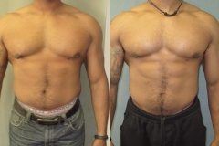 Puffy-Nipples-7282-3