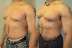 Puffy-Nipples-7282-4