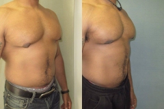 Puffy-Nipples-7282-6