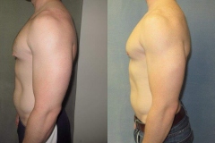 Puffy-Nipples-7371-2