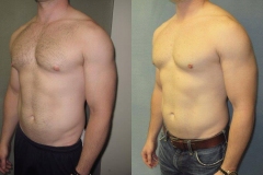 Puffy-Nipples-7371-4