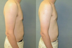 Puffy-Nipples-7435-2