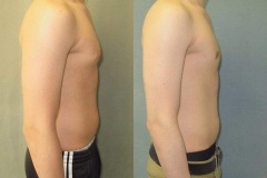 Puffy-Nipples-7446-3