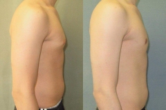 Puffy-Nipples-7446-6