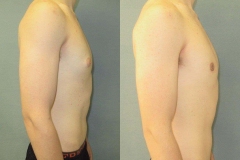 Puffy-Nipples-7809-2