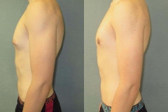 Puffy-Nipples-7809-3