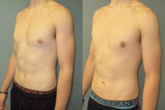 Puffy-Nipples-7809-5