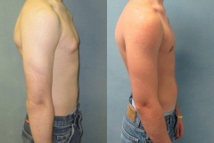 Puffy-Nipples-7842-2