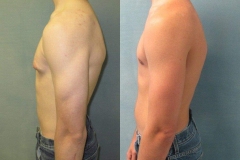 Puffy-Nipples-7842-3