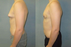 Puffy-Nipples-7851-2