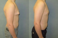 Puffy-Nipples-7851-3