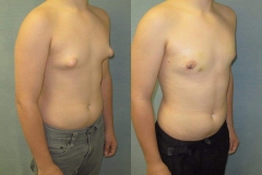 Puffy-Nipples-7851-4