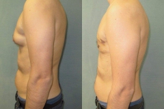 Puffy-Nipples-7902-3