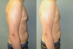 Puffy-Nipples-7902-5