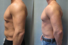 Combined-Procedures-5602-2