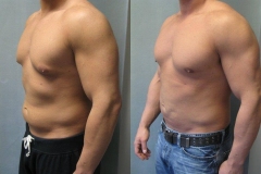 Combined-Procedures-5602-3