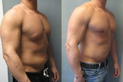 Combined-Procedures-5602-4