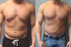 Combined-Procedures-5602-5