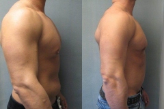 Combined-Procedures-5602