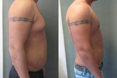 Combined-Procedures-6440-3